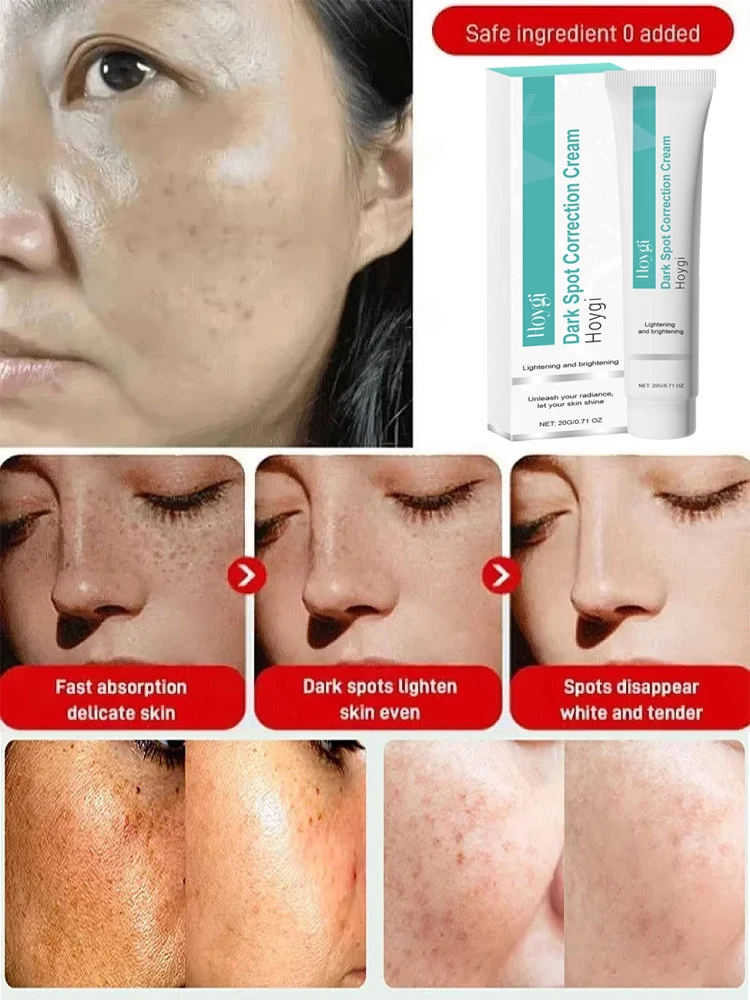 Мощный отбеливающий крем для у – обзор и цена Luxury Skincare Brands