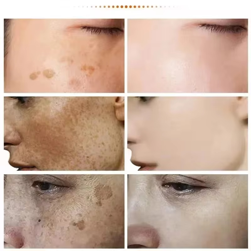 Мощный отбеливающий крем для у – обзор и цена Luxury Skincare Brands