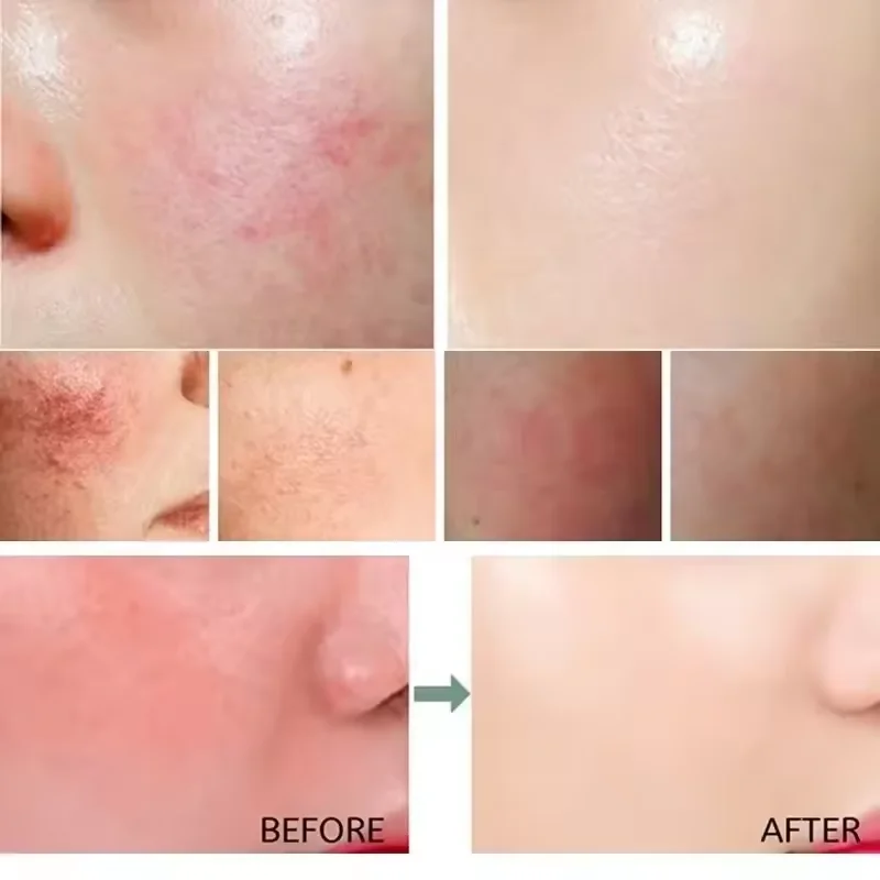 Восстанавливающий крем для лиц – обзор и цена Luxury Skincare Brands